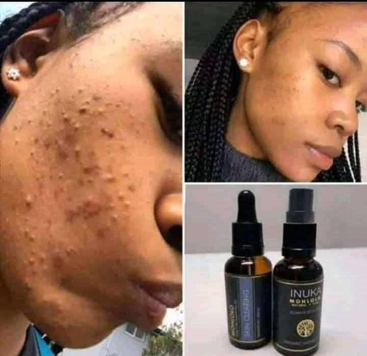 reliable inuka skin oils